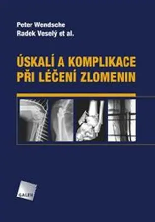 Úskalí a komplikace při léčení zlomenin - Peter Wendsche