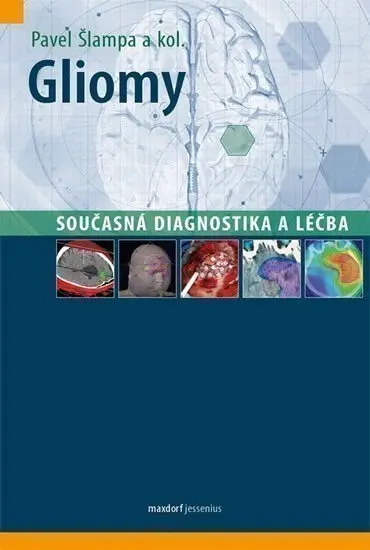 Gliomy - Současná diagnostika a léčba - kolektiv autorů