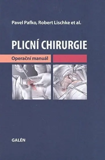 Plicní chirurgie - Pavel Pafko