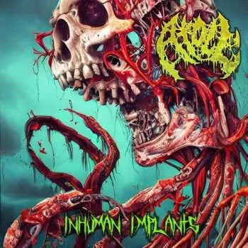 CD Atoll: Inhuman Implants