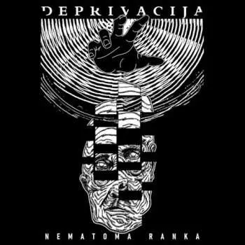 CD Deprivacija: Nematoma Ranka LTD | DIGI