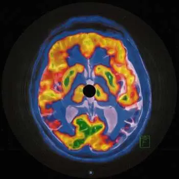 LP Frankey & Sandrino: Brainscan EP