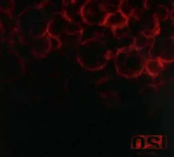 2CD OSI: Blood
