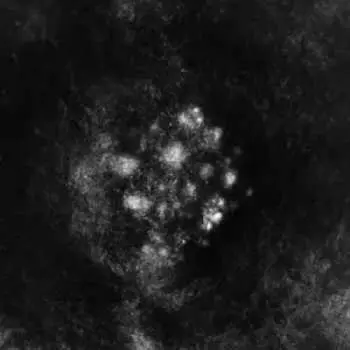 2LP Saffronkeira: Synecdoche