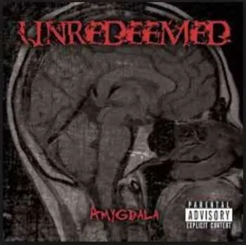 CD Unredeemed: Amygdala