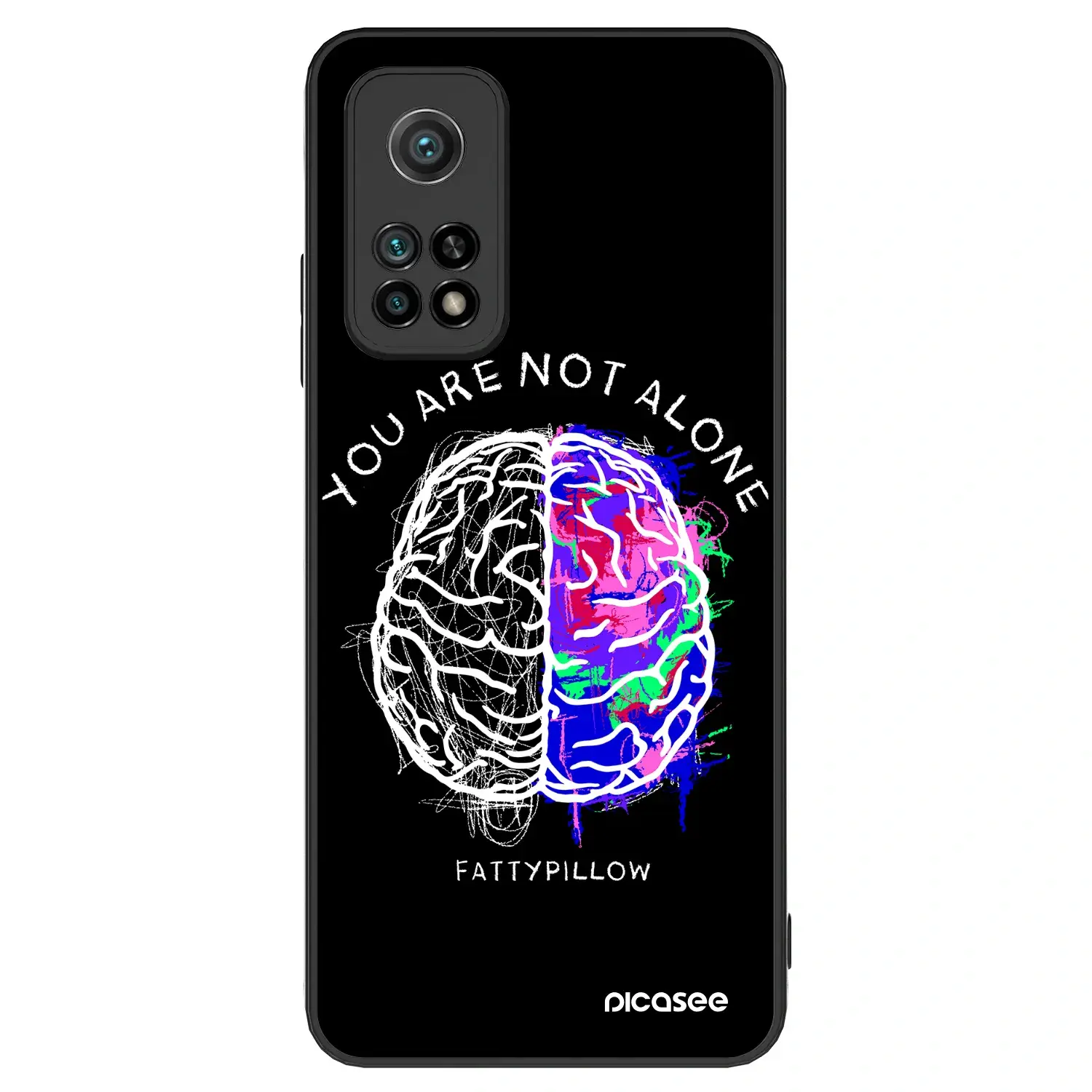 ULTIMATE CASE pro Xiaomi Mi 10T - Brain - White