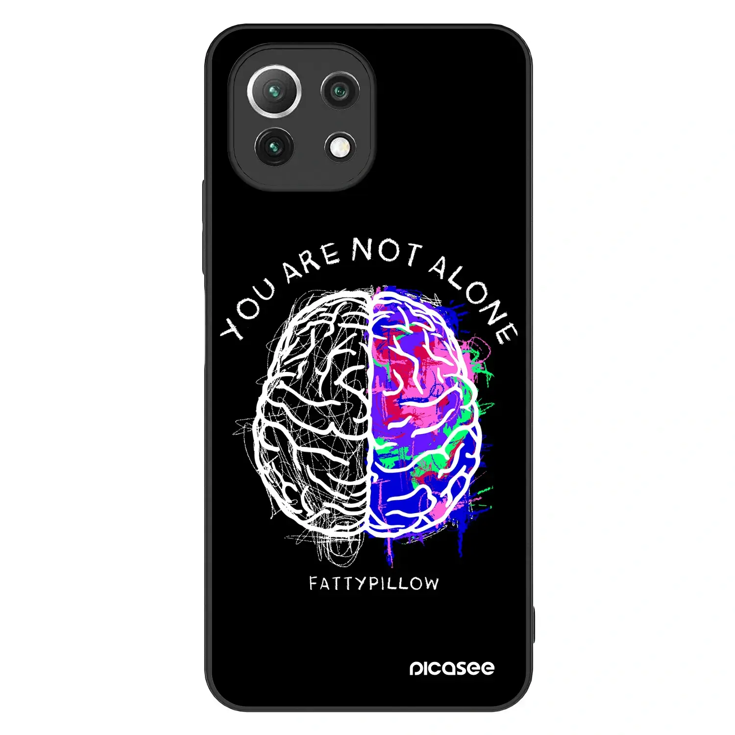 ULTIMATE CASE pro Xiaomi 11 Lite 5G NE - Brain - White