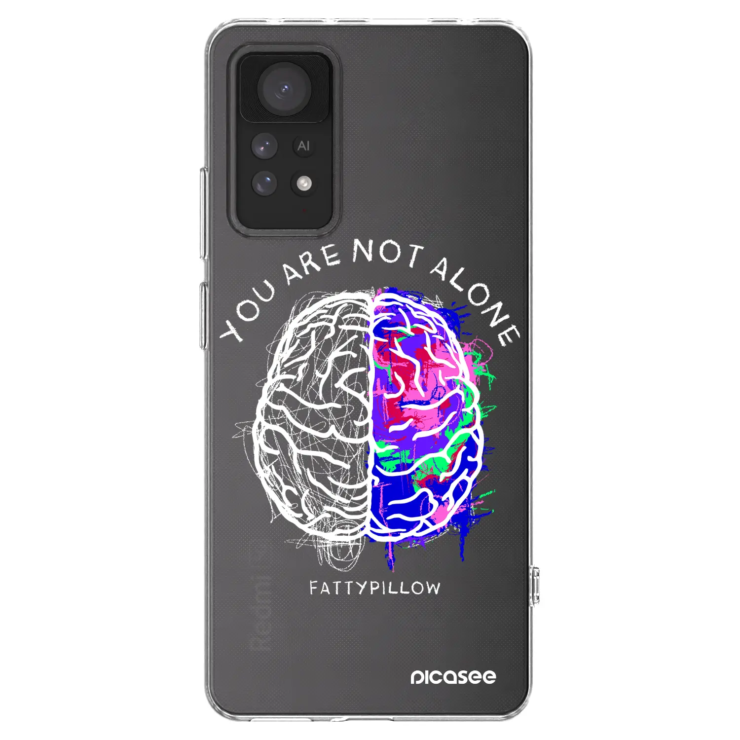 Silikonový průhledný obal pro Xiaomi Redmi Note 11 Pro 5G - Brain - White