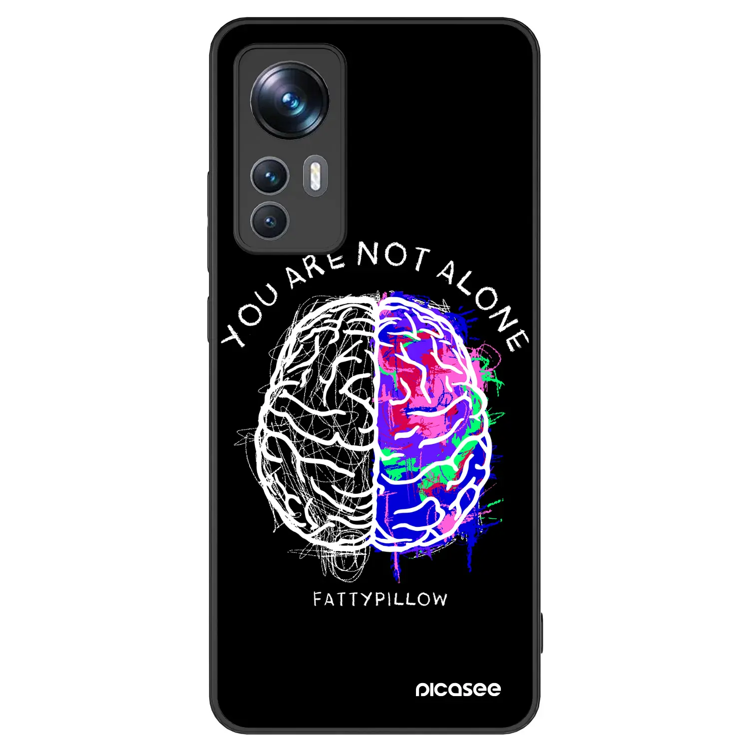 ULTIMATE CASE pro Xiaomi 12T Pro - Brain - White