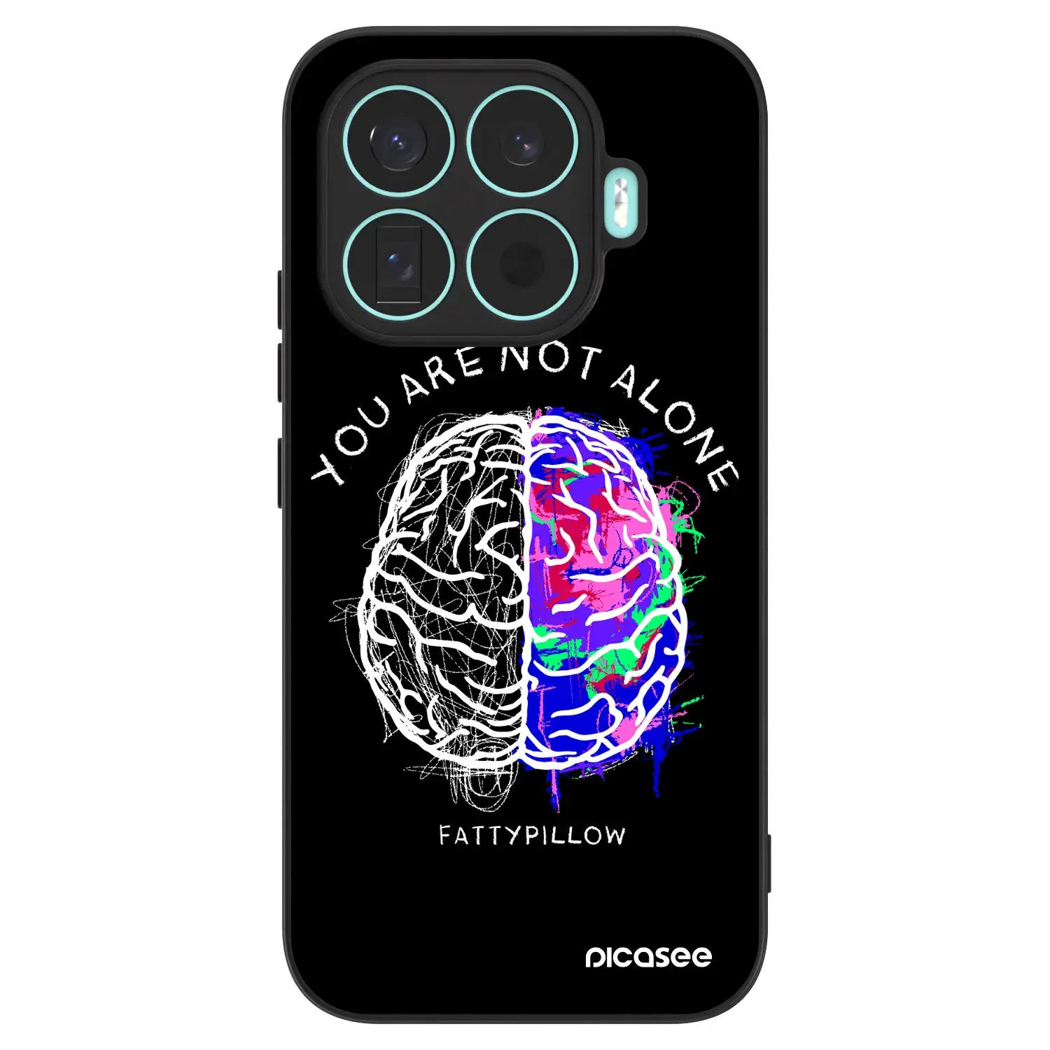ULTIMATE CASE pro Xiaomi 17T - Brain - White