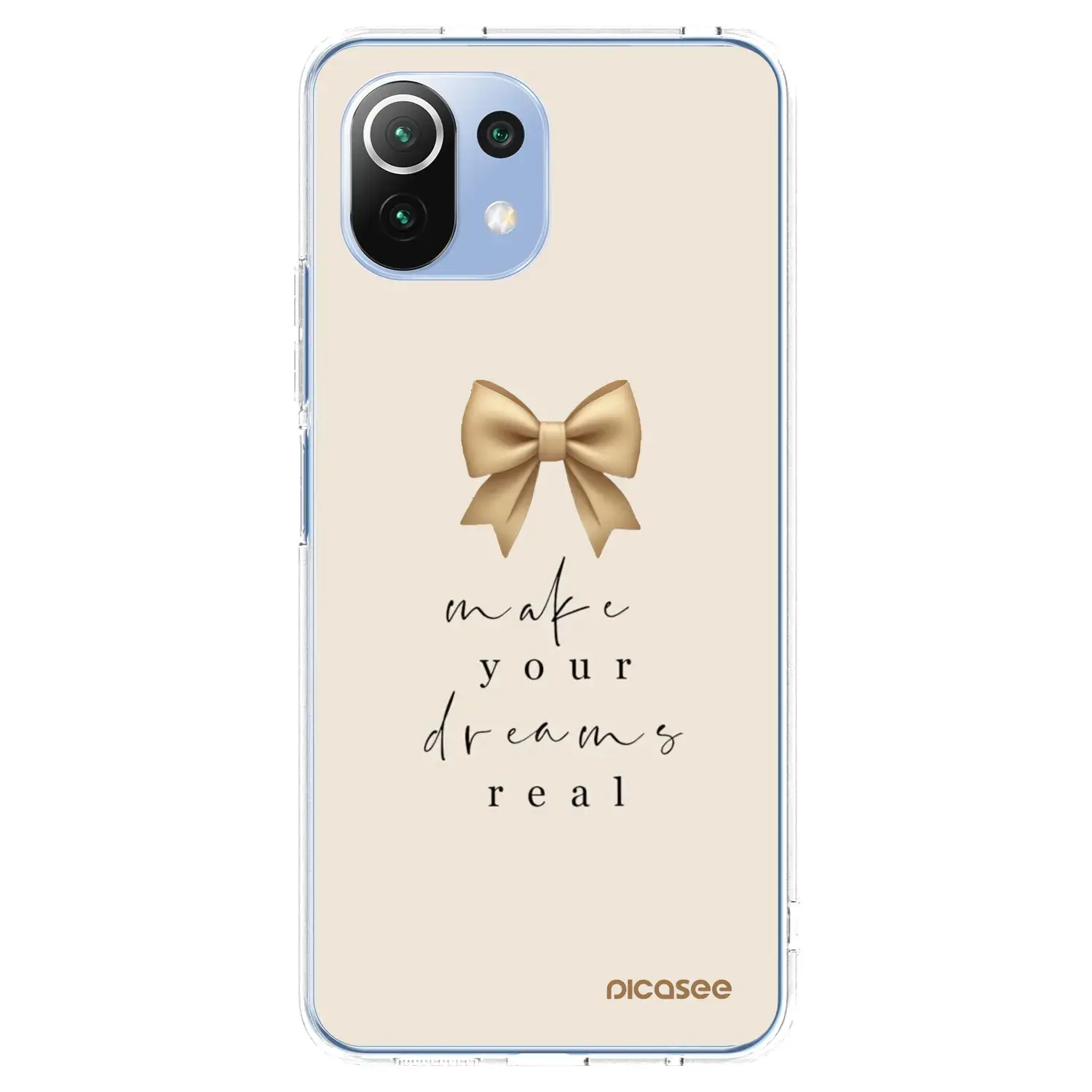 Silikonový průhledný obal pro Xiaomi 11 Lite 5G NE - Golden Dream
