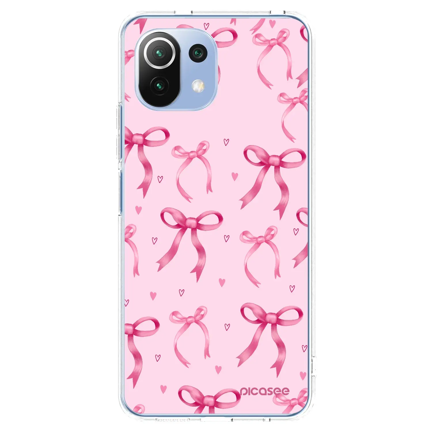 Silikonový průhledný obal pro Xiaomi Mi 11 Lite - Bow Aesthetic