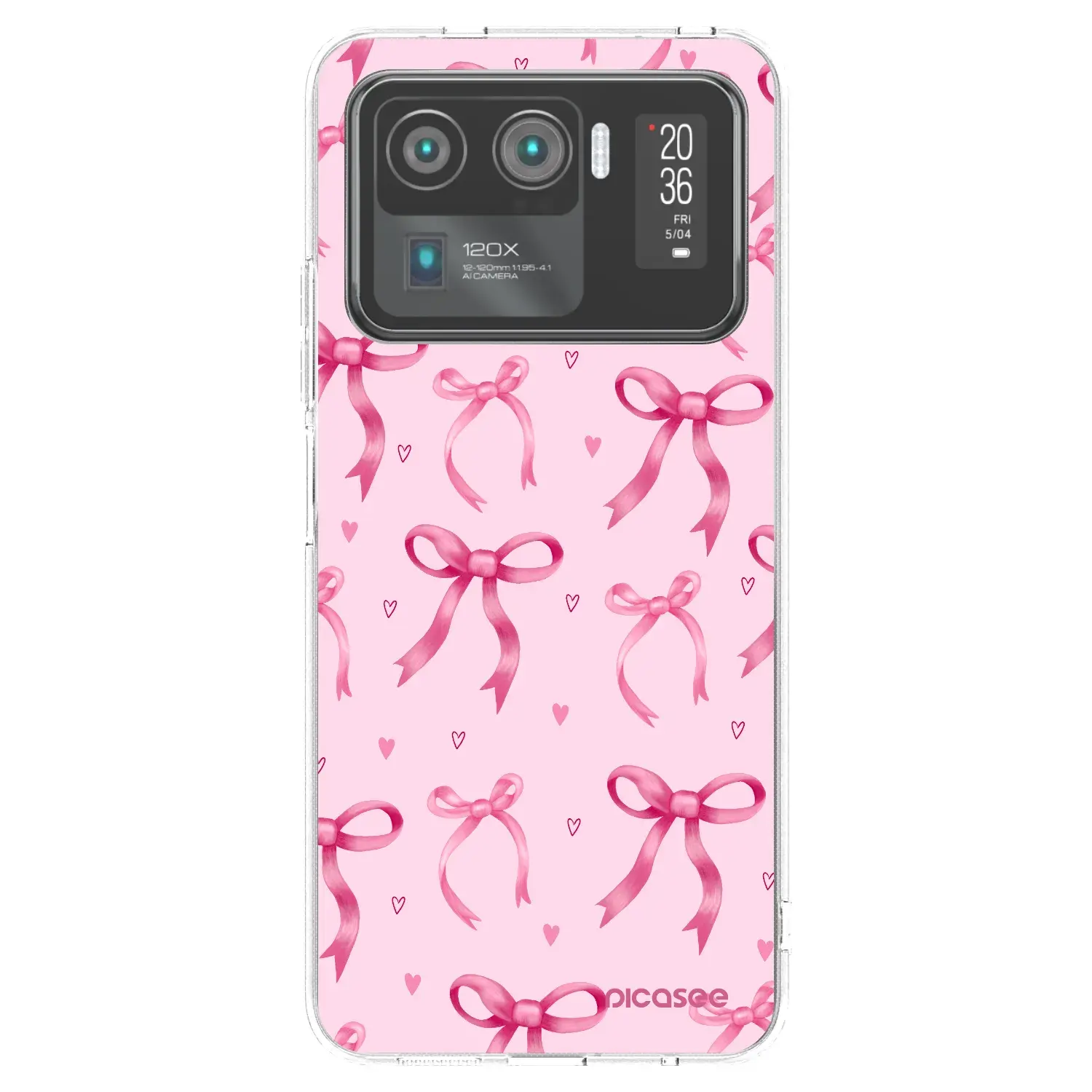 Silikonový průhledný obal pro Xiaomi Mi 11 Ultra - Bow Aesthetic