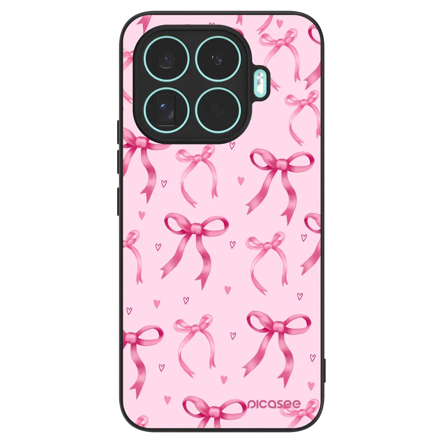 ULTIMATE CASE pro Xiaomi 17T Pro - Bow Aesthetic