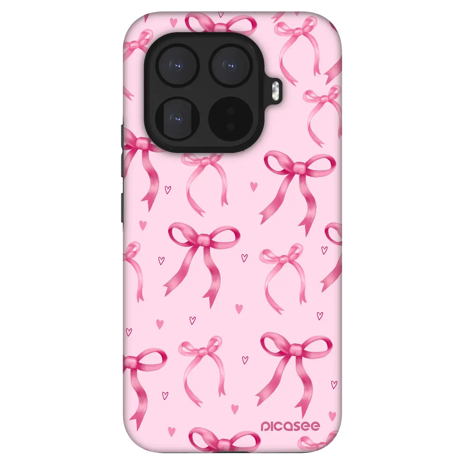 Fashion Case pro Xiaomi 15T Pro - Bow Aesthetic