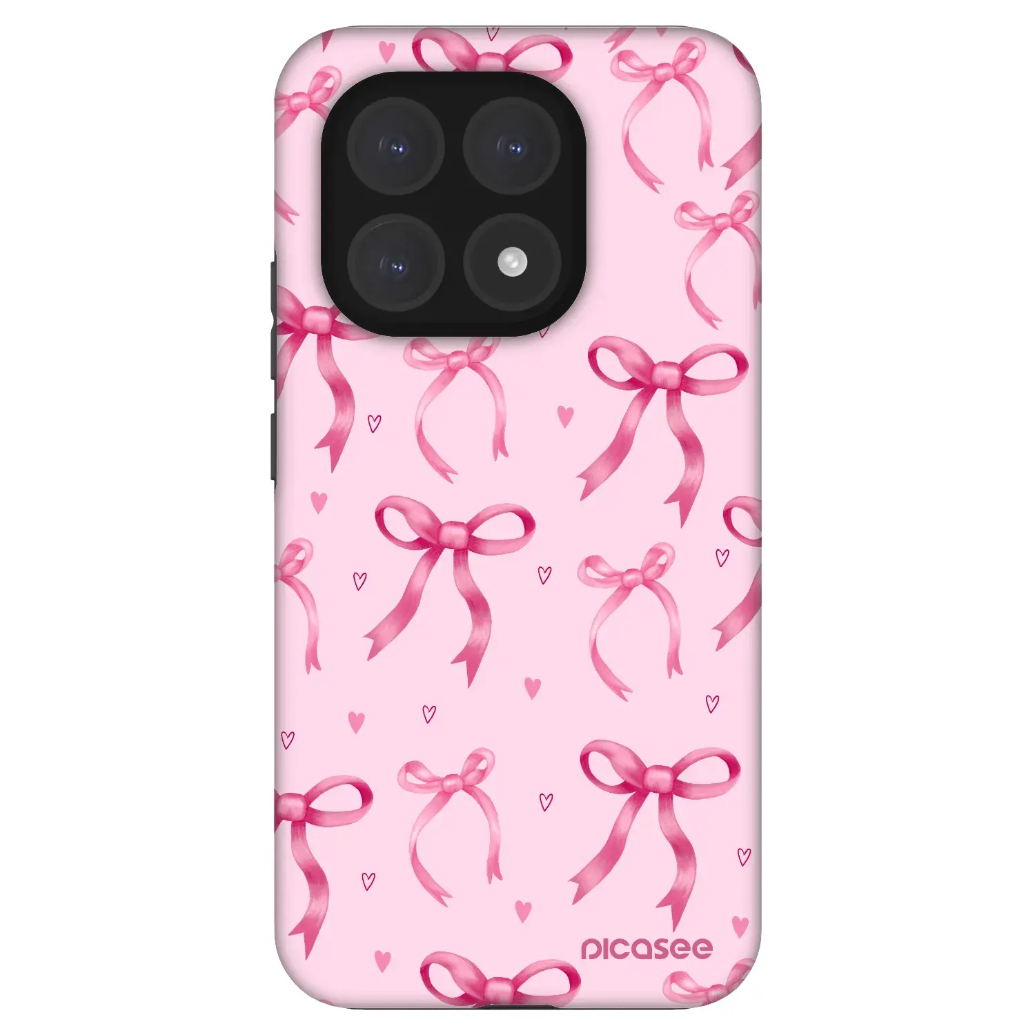 Fashion Case pro Xiaomi 15T - Bow Aesthetic