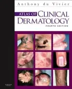 Atlas of Clinical Dermatology - du Vivier, Anthony (Physician in Charge, The Skin Department, King's College Hospital, London, UK)