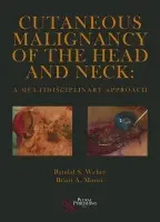 Cutaneous Malignancy of the Head and Neck - Weber, Randal S. a Moore, Brian A.