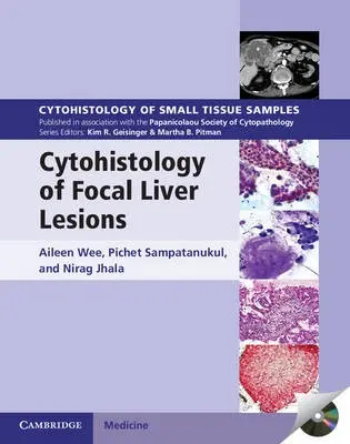Cytohistology of Focal Liver Lesions - Wee, Aileen (National University of Singapore) a Sampatanukul, Pichet (Chulalongkorn University, Thailand) a Jhala, Nirag (University of Pennsylvania)