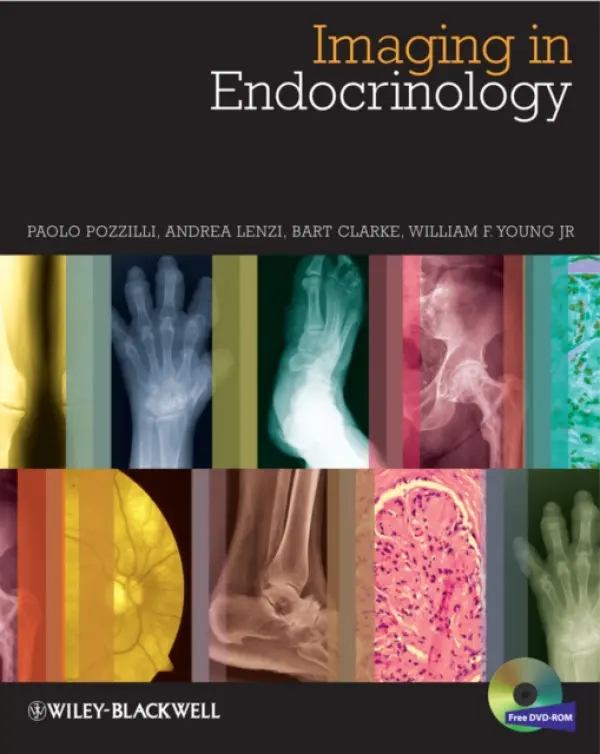 Imaging in Endocrinology - Pozzilli, Paolo (Queen Mary University of London, London, UK) a Lenzi, Andrea (Sapienza University of Rome, Policlinico Umberto I, Rome, Italy) a Clarke, Bart L. (Mayo Clinic College of Medicine, Rochester, MN, USA) a Young, William F. (Mayo Clinic College of M