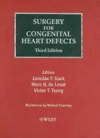 Surgery for Congenital Heart Defects