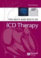 Nuts and Bolts of ICD Therapy - Kenny, Tom (St. Jude Medical, Austin, Texas)