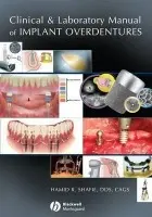 Clinical and Laboratory Manual of Implant Overdentures - Shafie, Hamid R. (President, American Institute of Implant Dentistry)