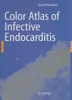 Color ᴀtlas of Infective Endocarditis - David R. Ramsdale