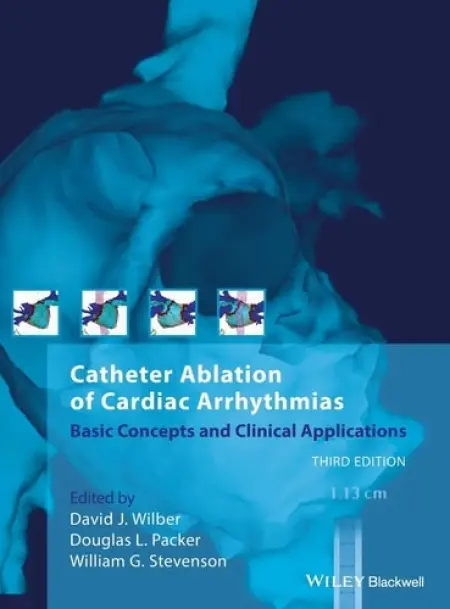 Catheter Ablation of Cardiac Arrhythmias