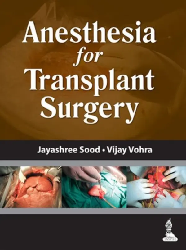 Anesthesia for Transplant Surgery - Sood, Jayashree a Vohra, Vijay