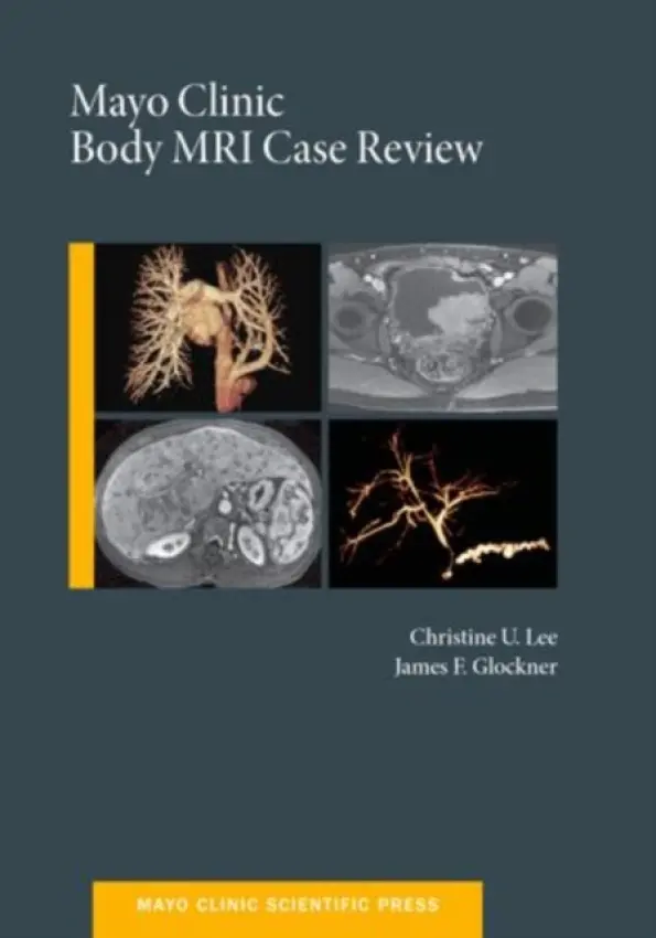 Mayo Clinic Body MRI Case Review - Lee, Christine U.C. (MD, PhD, MD, PhD, Consultant, Department of Radiology, Mayo Clinic, Rochester, USA Assistant Professor Radiology, Mayo Clinic College of Medicine, Rochester, USA) a Glockner, James (MD, PhD, MD, PhD, Consultant, Department of Radiologyu