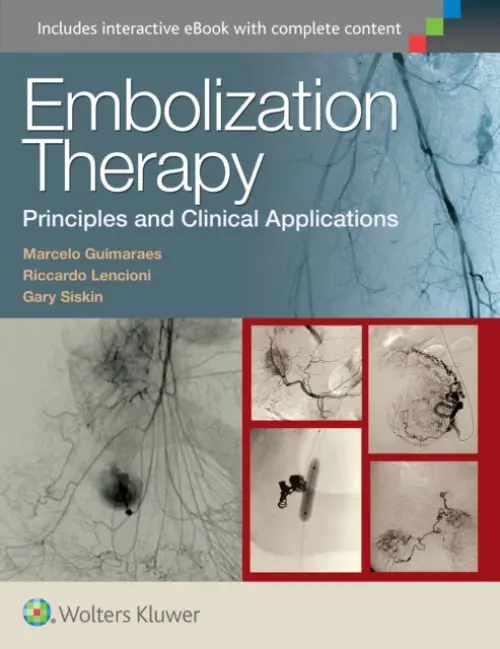 Embolization Therapy: Principles and Clinical Applications - Guimaraes, Marcelo, MD, FSIR a Lencioni, Dr. Riccardo, MD, FSIR, EBIR a Siskin, Dr. Gary P., MD, FSIR