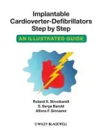 Implantable Cardioverter - Defibrillators Step by Step - Stroobandt, Roland X. (Professor of Medicine, Heart Center, University Hospital, Ghent, Belgium a Department of Cardiology, A.Z. Damiaan Hospital, Ostend, Belgium) a Barold, S. Serge (University of South Florida) a Sinnaeve, Alfons F. (Professor Emeritus of El