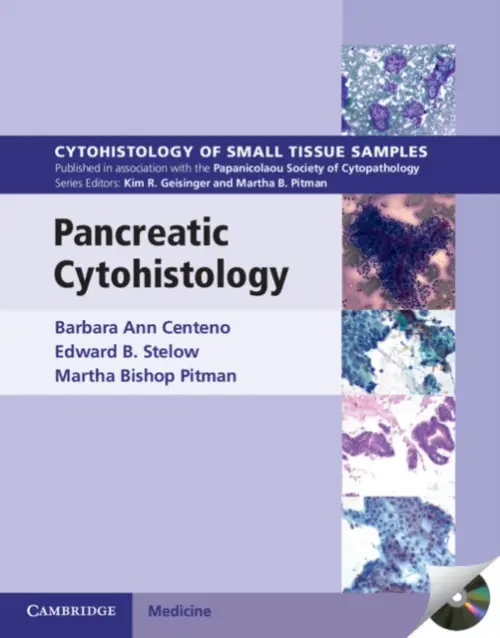 Pancreatic Cytohistology - Centeno, Barbara Ann (University of South Florida College of Medicine) a Stelow, Edward B. (University of Virginia) a Pitman, Martha Bishop (Harvard Medical School)