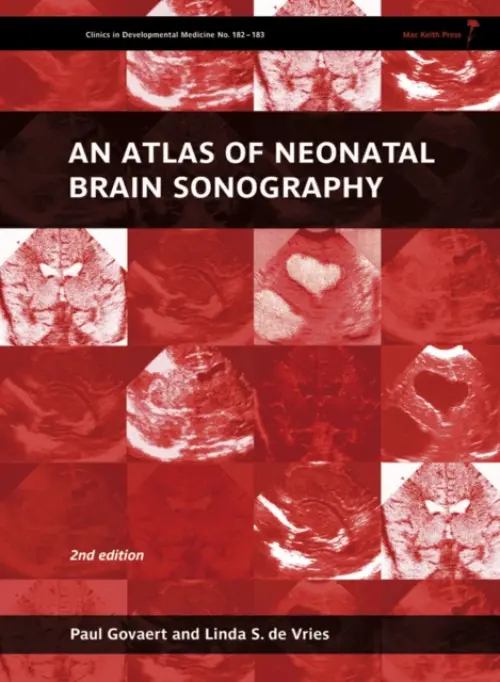 An ᴀtlas of Neonatal Brain Sonography - Paul Govaert, Linda S. de Vries