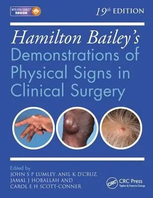 Hamilton Bailey's Physical Signs - Lumley, John S. P. (Emeritus Professor of Vascular Surgery, University of London a Past Council Member and Chairman of Primary Fellowship Examinations, Royal College of Surgeons of England, UK) a D'Cruz, Anil K. (Director, Tata Memorial Hospital a Professor a