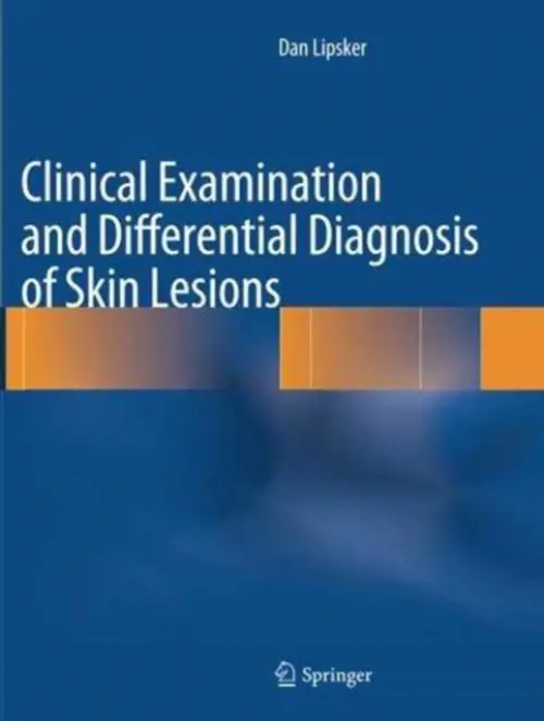Clinical Examination and Differential Diagnosis of Skin Lesions - Lipsker, Dan