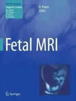 Fetal MRI
