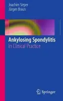 Ankylosing Spondylitis - Sieper, Joachim a Braun, Jurgen