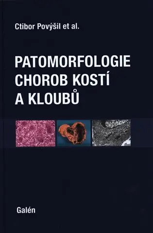 Patomorfologie chorob kostí a kloubů - Ctibor Povýšil