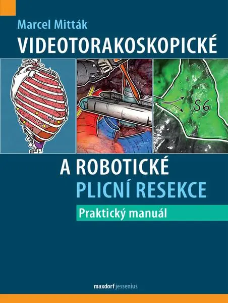 Videotorakoskopické a robotické plicní resekce