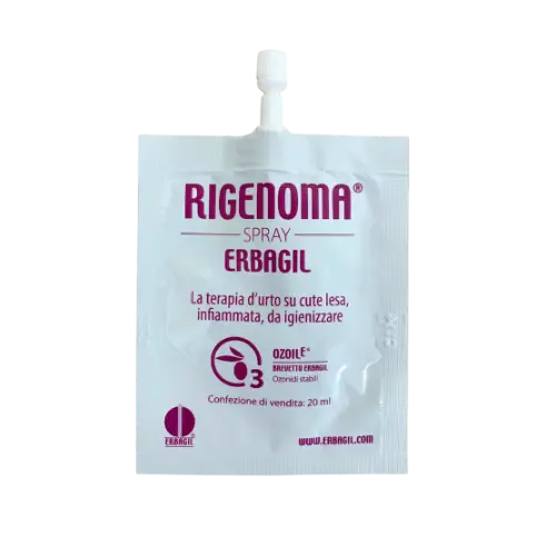 RIGENOMA – VZOREK bioaktivní sprej na rány s OZOILE 3 ml
