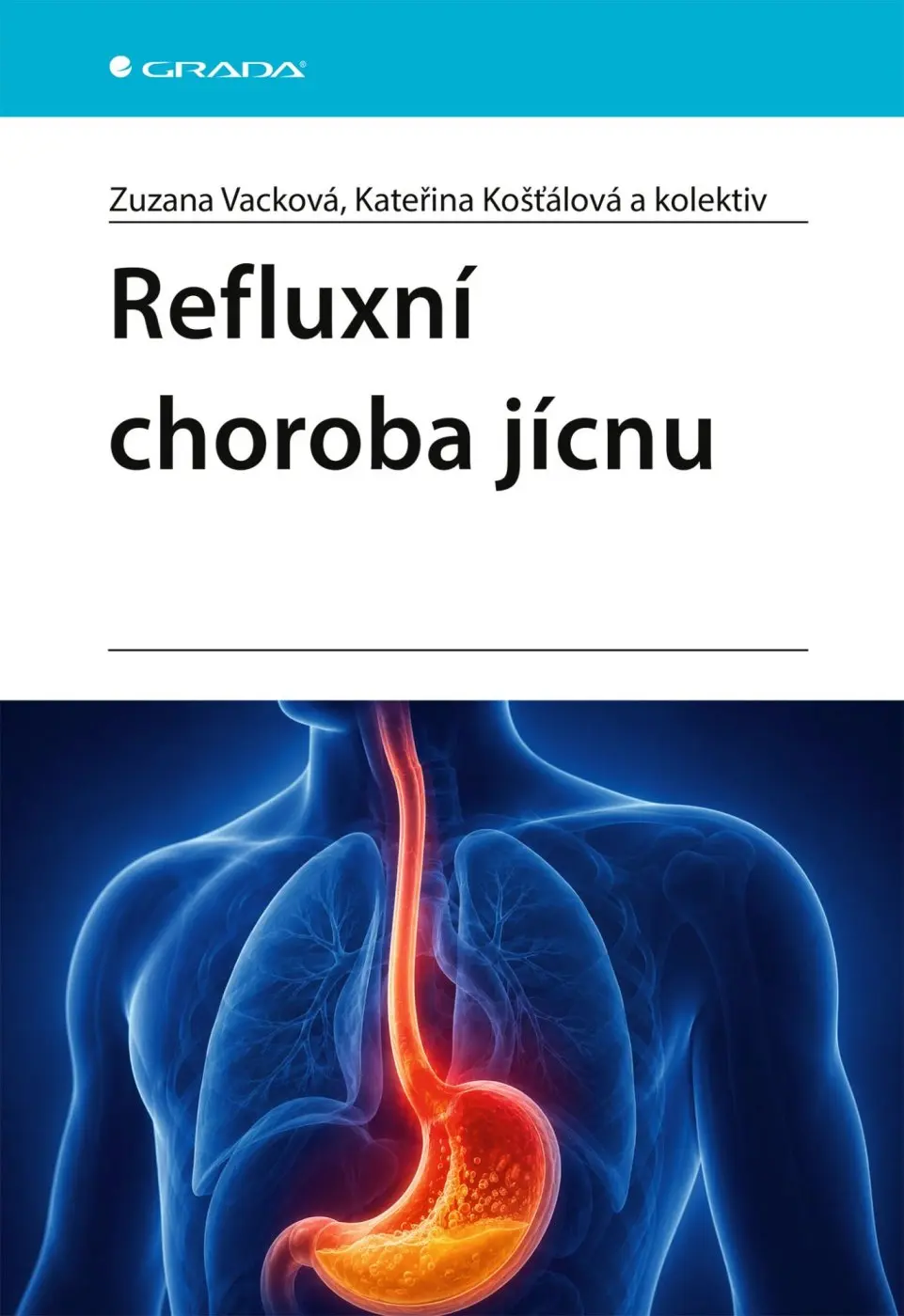 Refluxní choroba jícnu - Zuzana Vačková