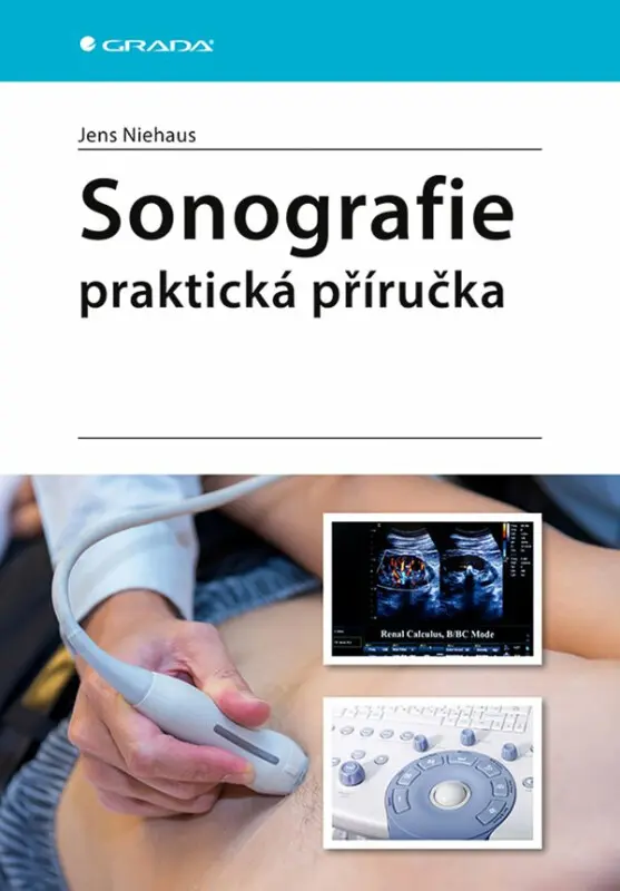 Sonografie - praktická příručka
