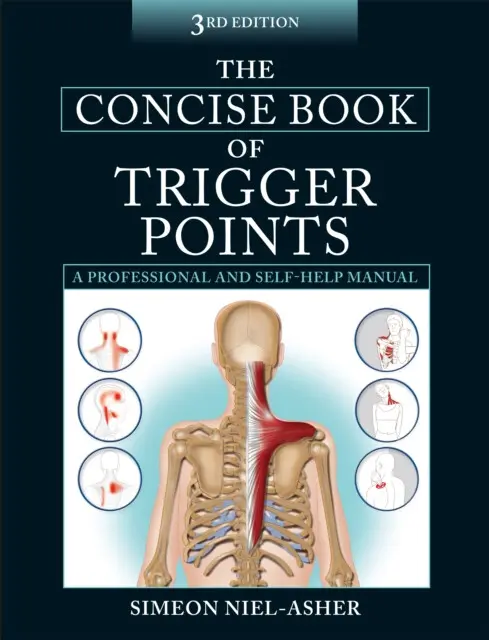Concise Book of Trigger Points - Niel-Asher, Simeon