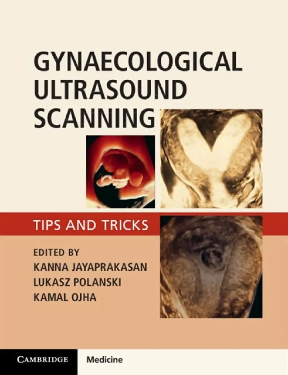 Gynaecological Ultrasound Scanning - Kamal Ojha, Lukasz Polanski, Kanna Jayaprakasan