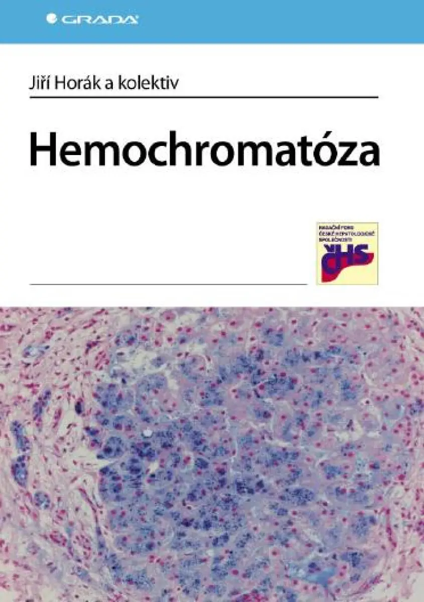 Hemochromatóza - Jiří Horák