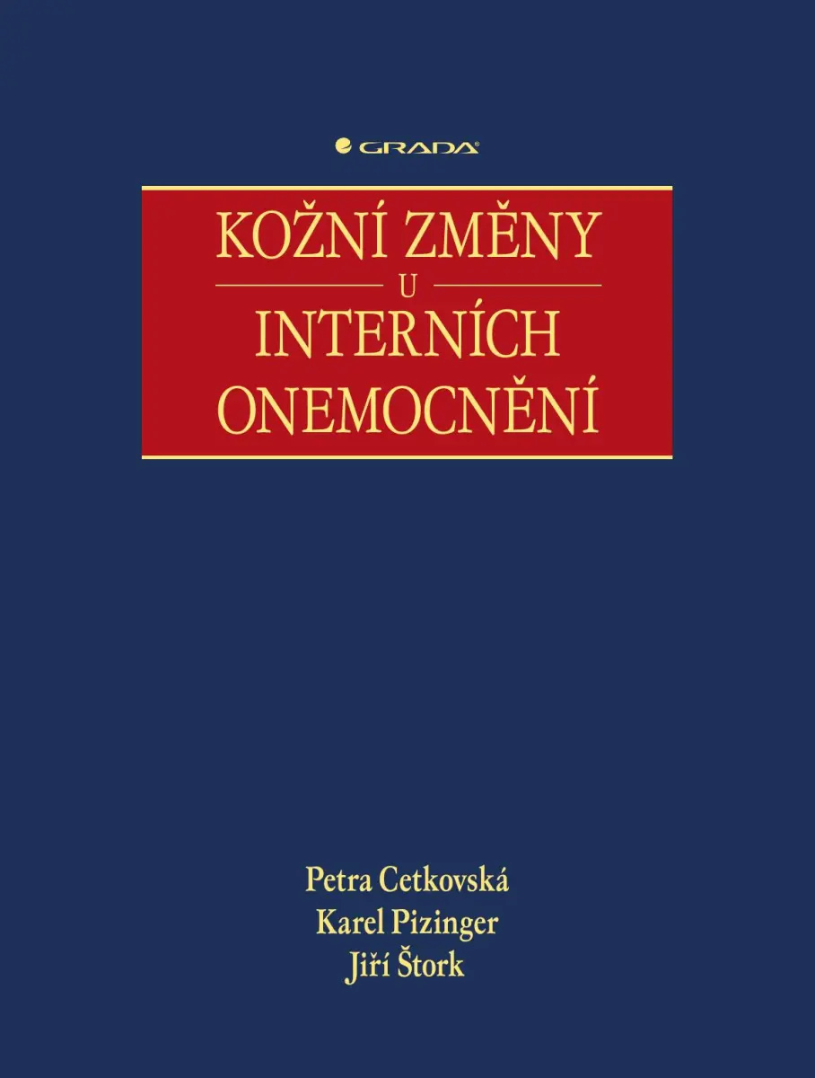 Kožní změny u interních onemocnění - Petra Cetkovská, Karel Pizinger, Jiří Štork