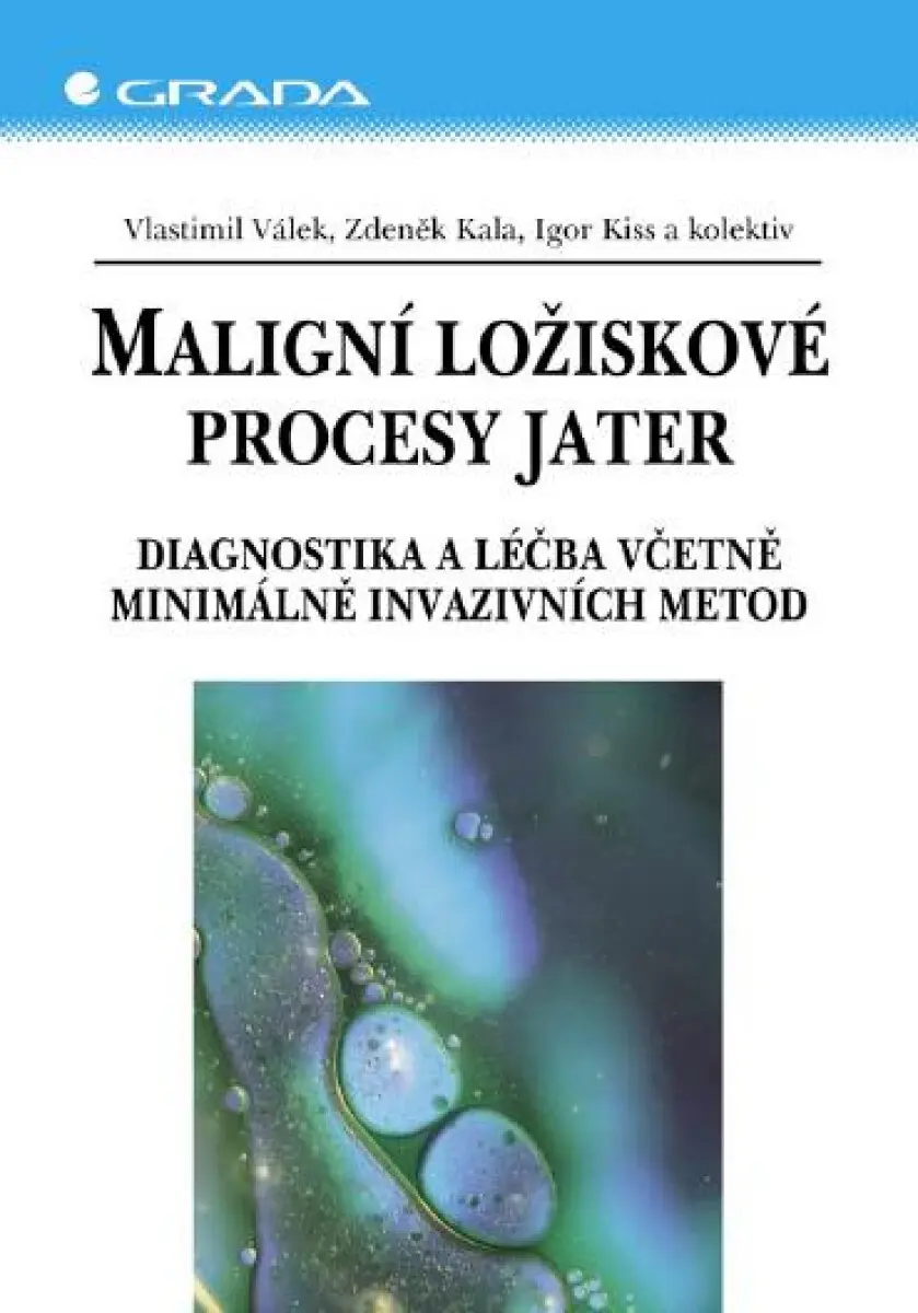 Maligní ložiskové procesy jater - Zdeněk Kala, Igor Kiss, Vlastimil Válek