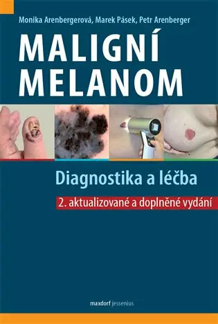 Maligní melanom - Diagnostika a léčba - Monika Arenbergerová